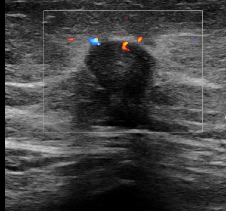 ultrasound(US) images
